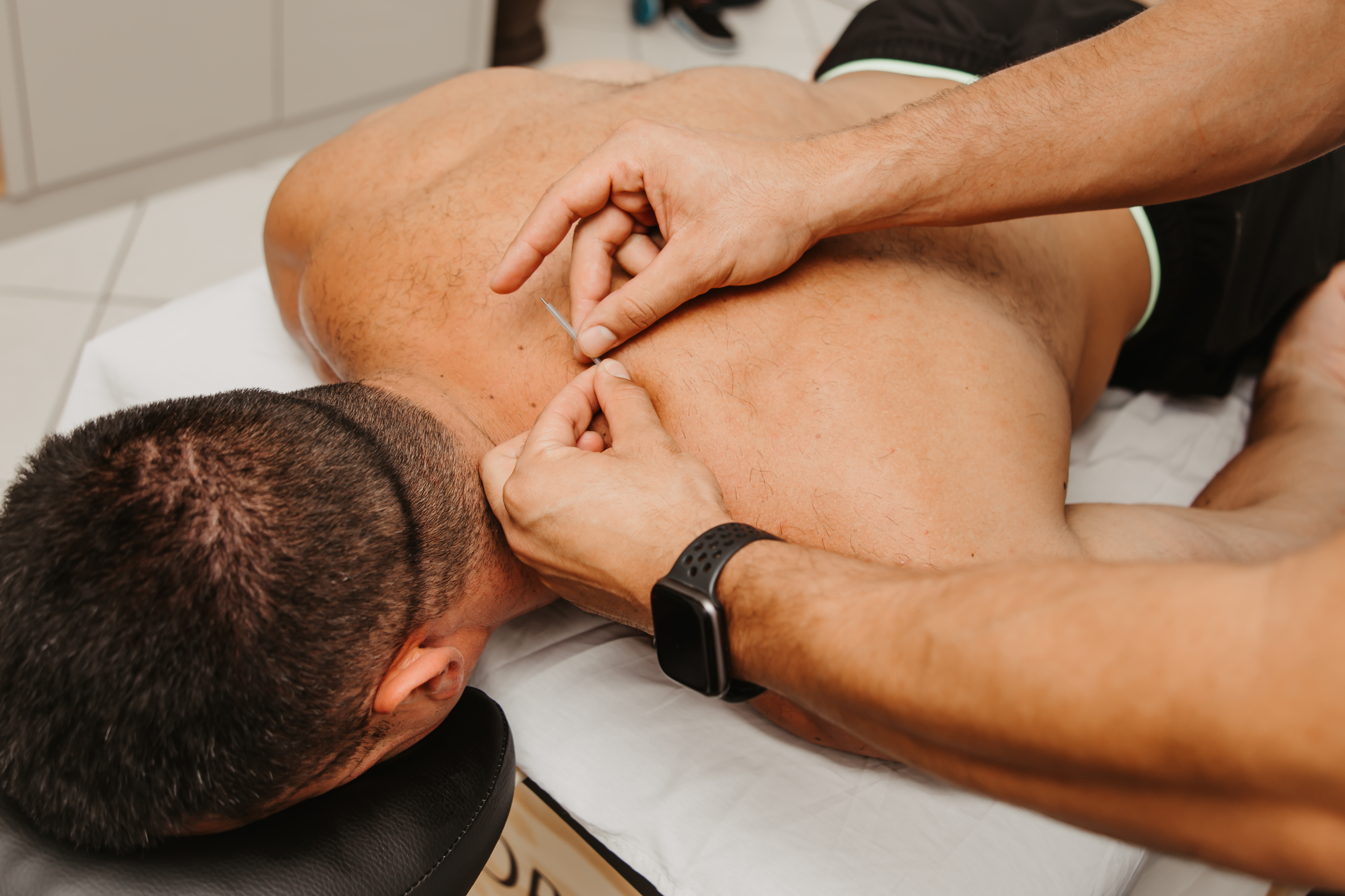 Dry Needling